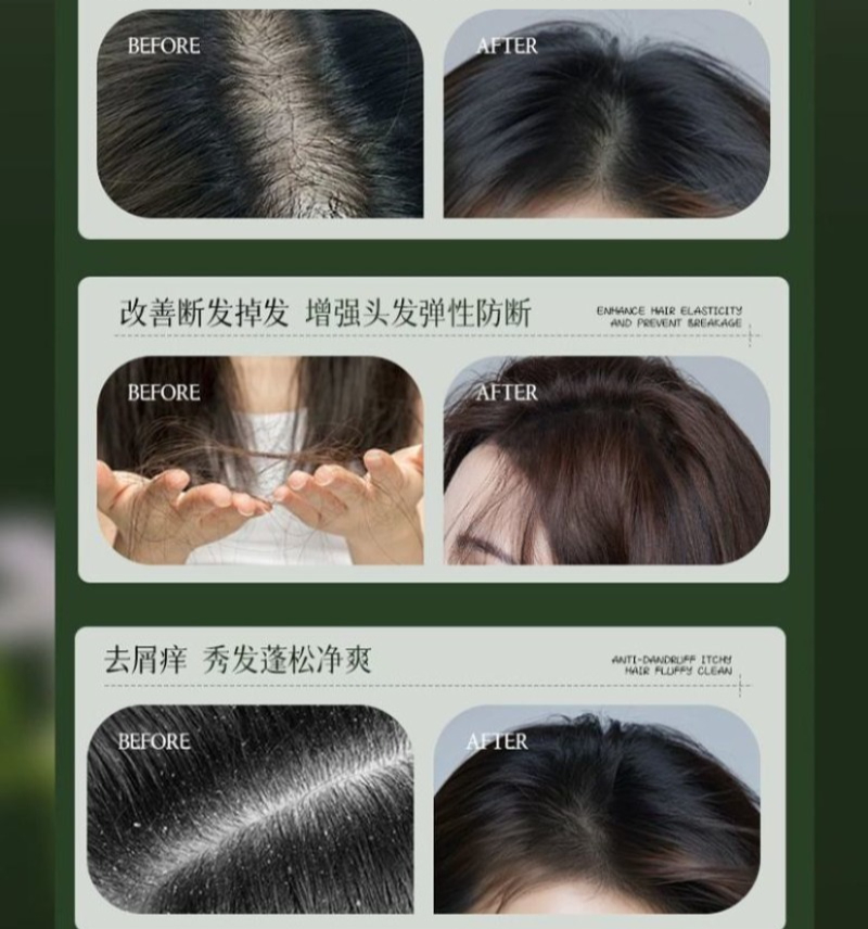 Шампунь AJAK Usman Grass для к – обзор и цена Hair Care Dandruff